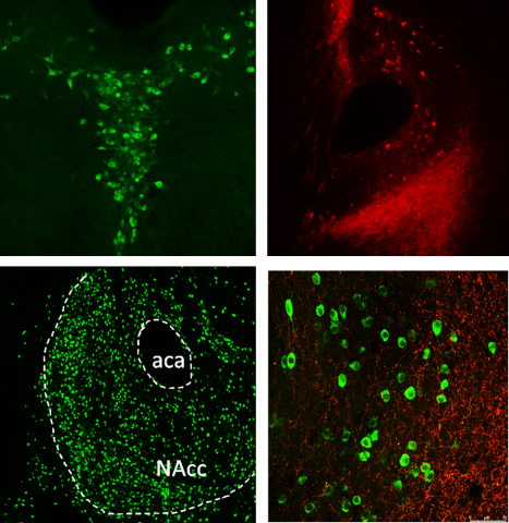 images of mouse dorsal raphe and nucleus accumbens, and the projections of serotonergic neurons from raphe to the accumbems