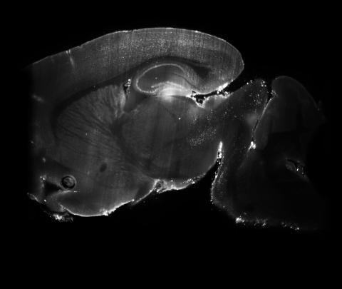 sagittal image of a mouse brain with cfos reactivity from iDISCO